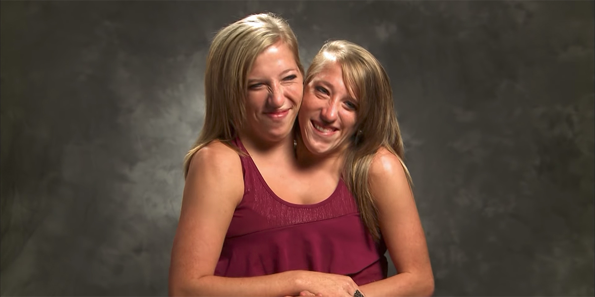 ABIGAIL AND BRITTANY HENSEL